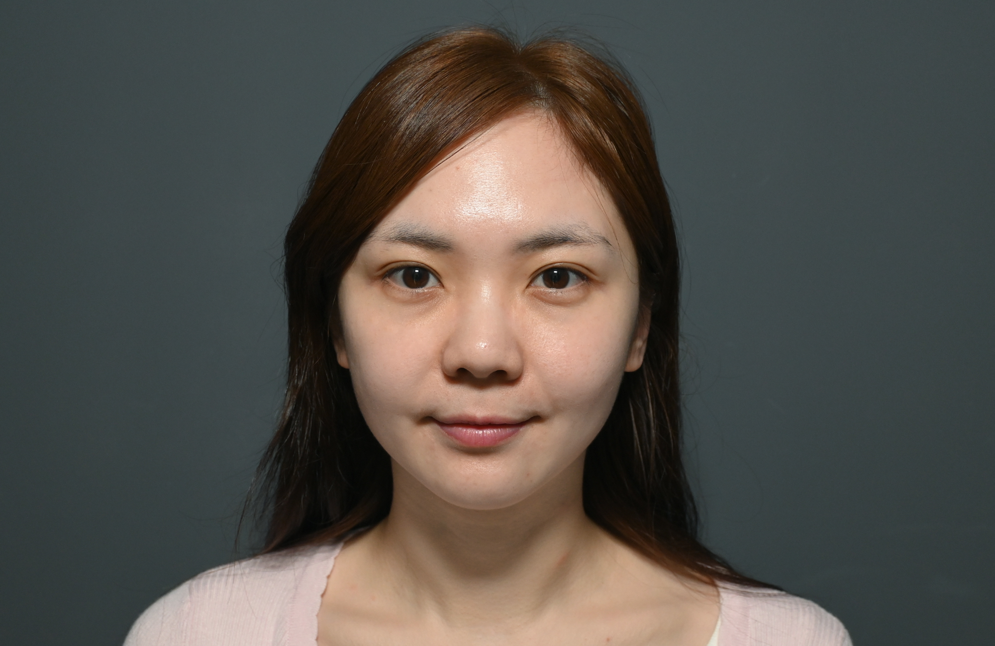 【海芙電音雙波】44公斤的圓臉苦惱：解析「皮相重於骨相」的輪廓課題